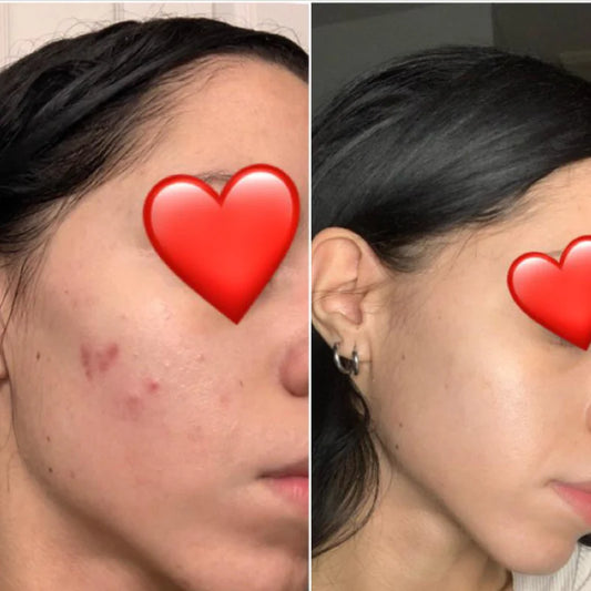 Dr. Althea 345 Relief Cream