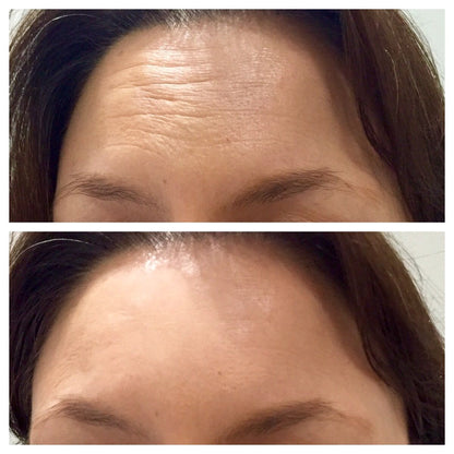 Celimax Retinal Shot Tightening Booster