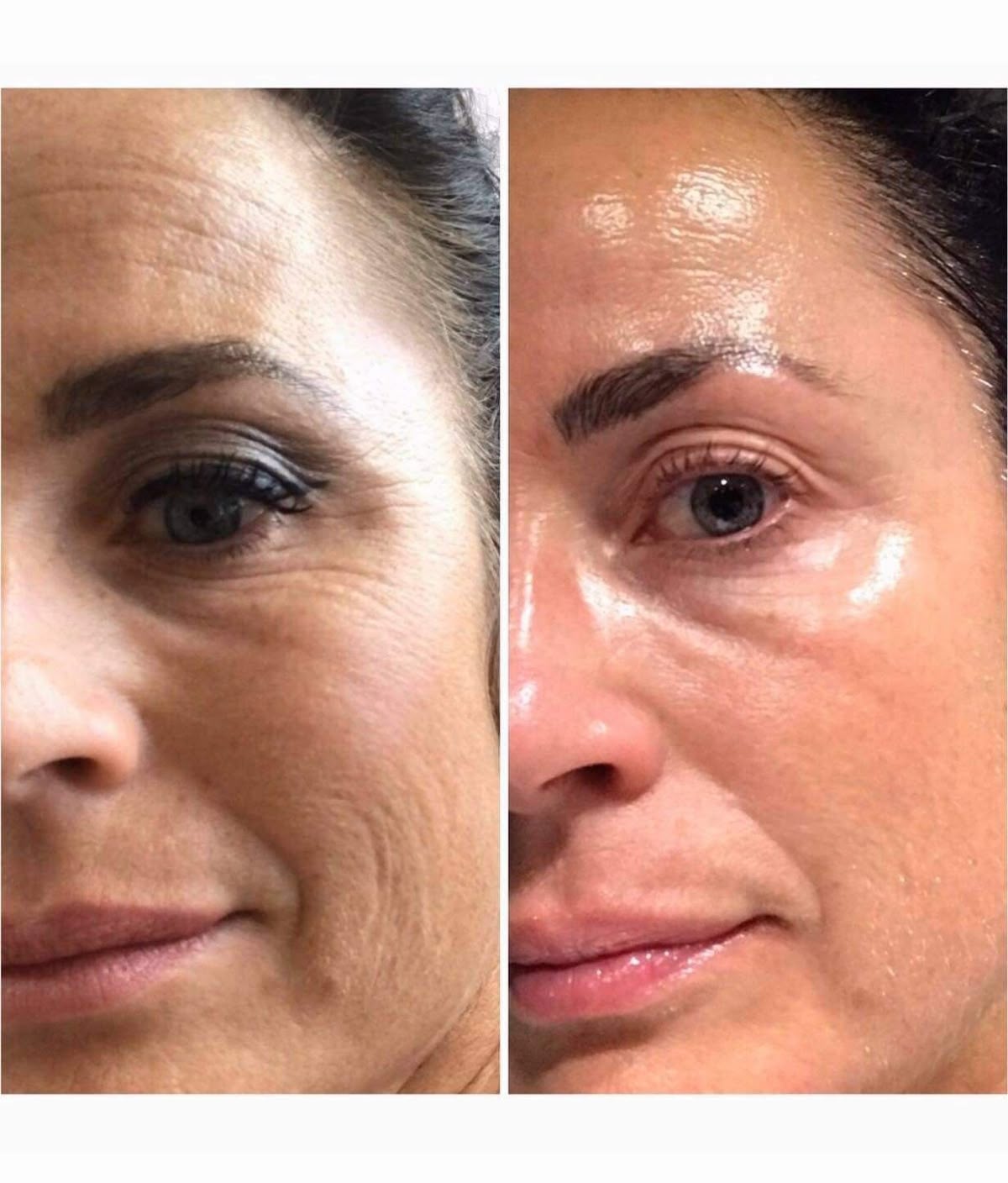 Celimax Retinal Shot Tightening Booster